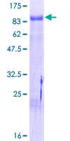 Human NR4A1 / NUR77 Protein (Recombinant GST)