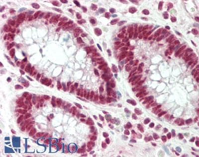Polyclonal Rabbit anti-Human PUF60 Antibody (C-Terminus, IHC, WB)
