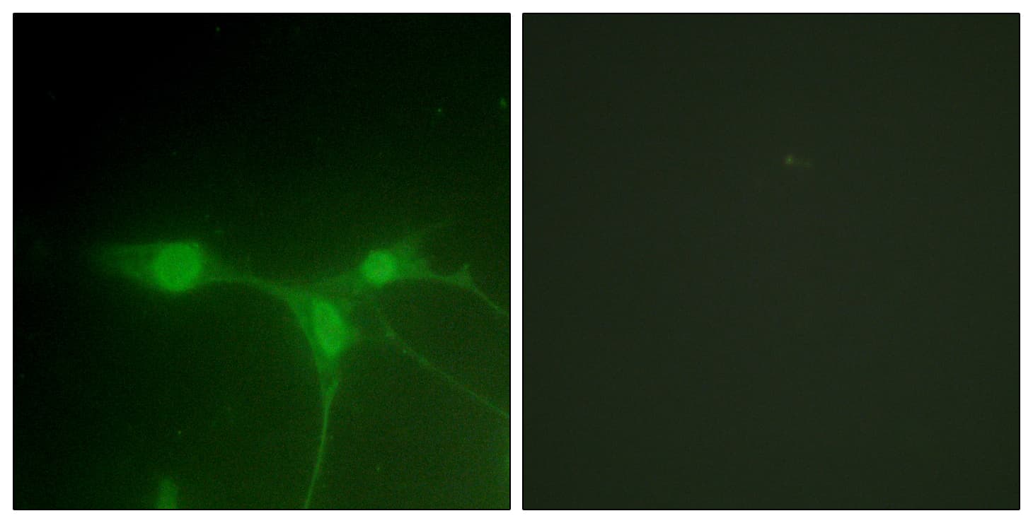 Polyclonal Rabbit anti-Human PTK6 / BRK Antibody (aa402-451, IF)