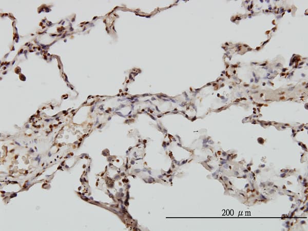 Monoclonal Mouse anti-Human EML2 / EMAP2 Antibody (clone 2H6, IHC)