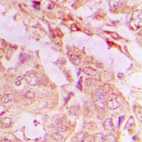 Polyclonal Rabbit anti-Human TOB2 Antibody (IHC, WB)