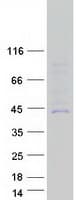 Human CYP27C1 Protein (Recombinant Myc-DDK (Flag))