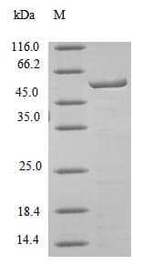 Mouse Ces1c / Carboxylesterase 1C Protein (Recombinant)