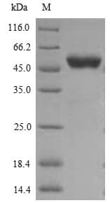 Human CCNB1 / Cyclin B1 Protein (Recombinant 6His, N-terminus)