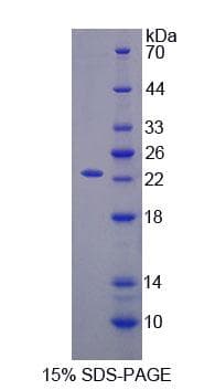 Rat TIMP2 Protein (Recombinant 6His, N-terminus)