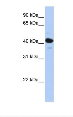 Polyclonal Rabbit anti-Human HSD2 / HSD11B2 Antibody (N-Terminus, WB)