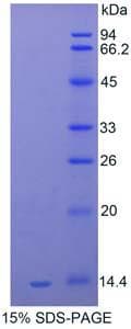 Mouse Serum Amyloid A Protein (Recombinant His)
