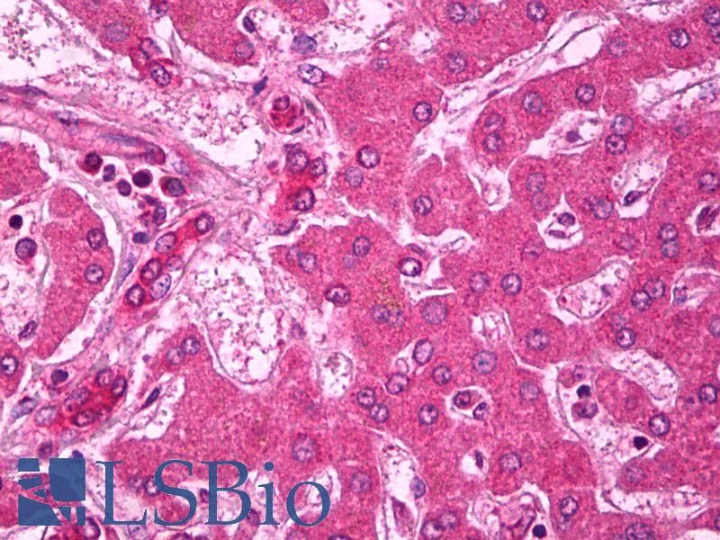 PathPlus™ ABCA1 Antibody (aa100-150)
