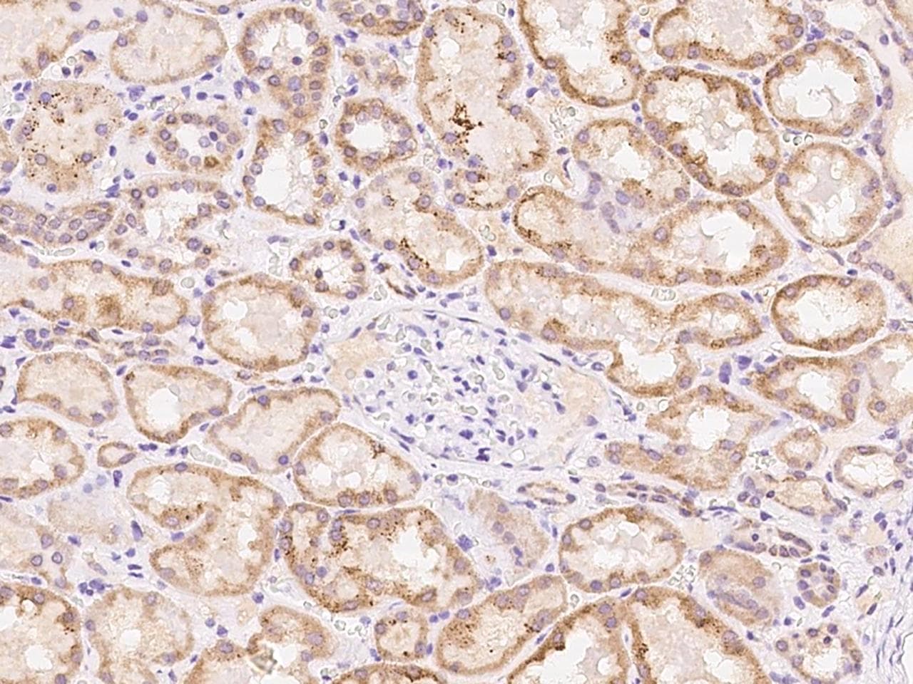 PDF / PLAB Antibody