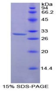 Mouse PRKCZ / PKC-Zeta Protein (Recombinant His-T7)