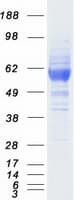 Human SCARB1 / SR-BI Protein (Recombinant Myc-DDK (Flag))