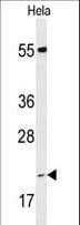 Polyclonal Rabbit anti-Human PPIC / Cyclophilin C Antibody (aa61-89, IHC, WB)