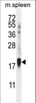 ZNF593 Antibody (aa62-88)