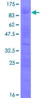 Human TULP1 Protein (Recombinant GST)