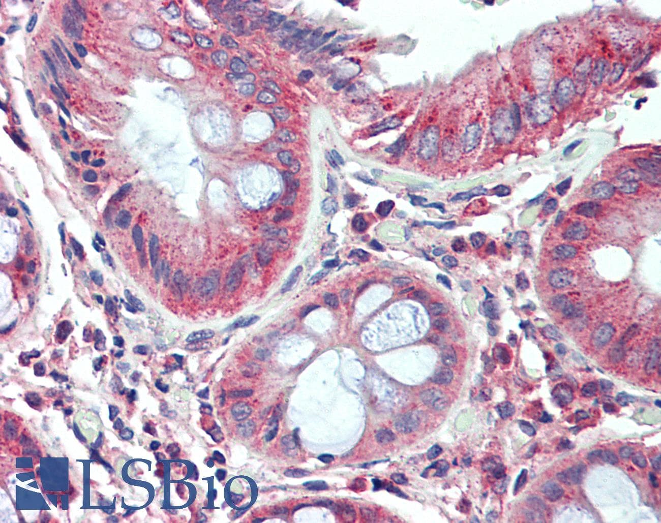 IHC-plus™ NEP / DDR1 Antibody (aa17-47)