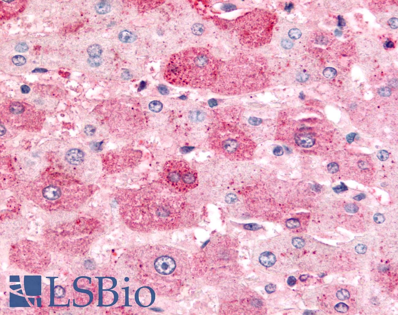 PathPlus™ Polyclonal Rabbit anti-Human MINK1 / MINK Antibody (Internal, IHC)