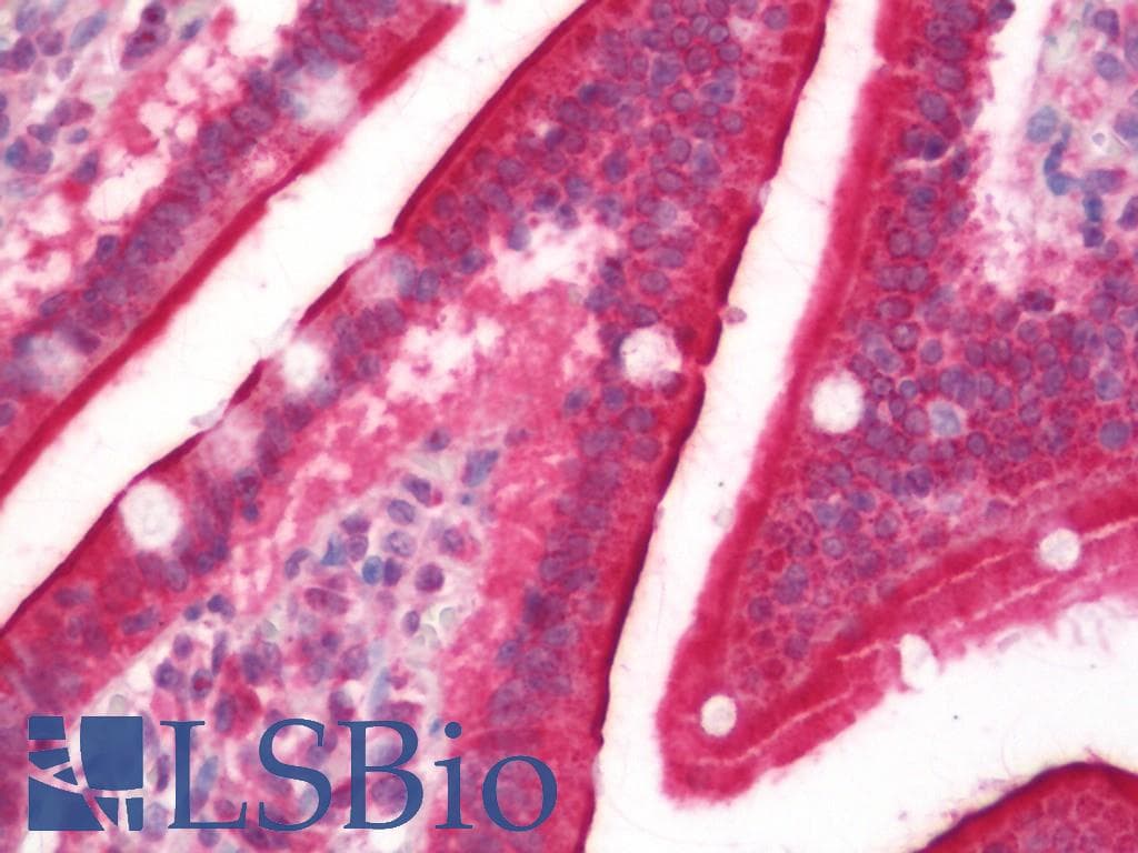 IHC-plus™ Polyclonal Rabbit anti-Human 15-PGDH / HPGD Antibody (aa205-266, IHC, WB)