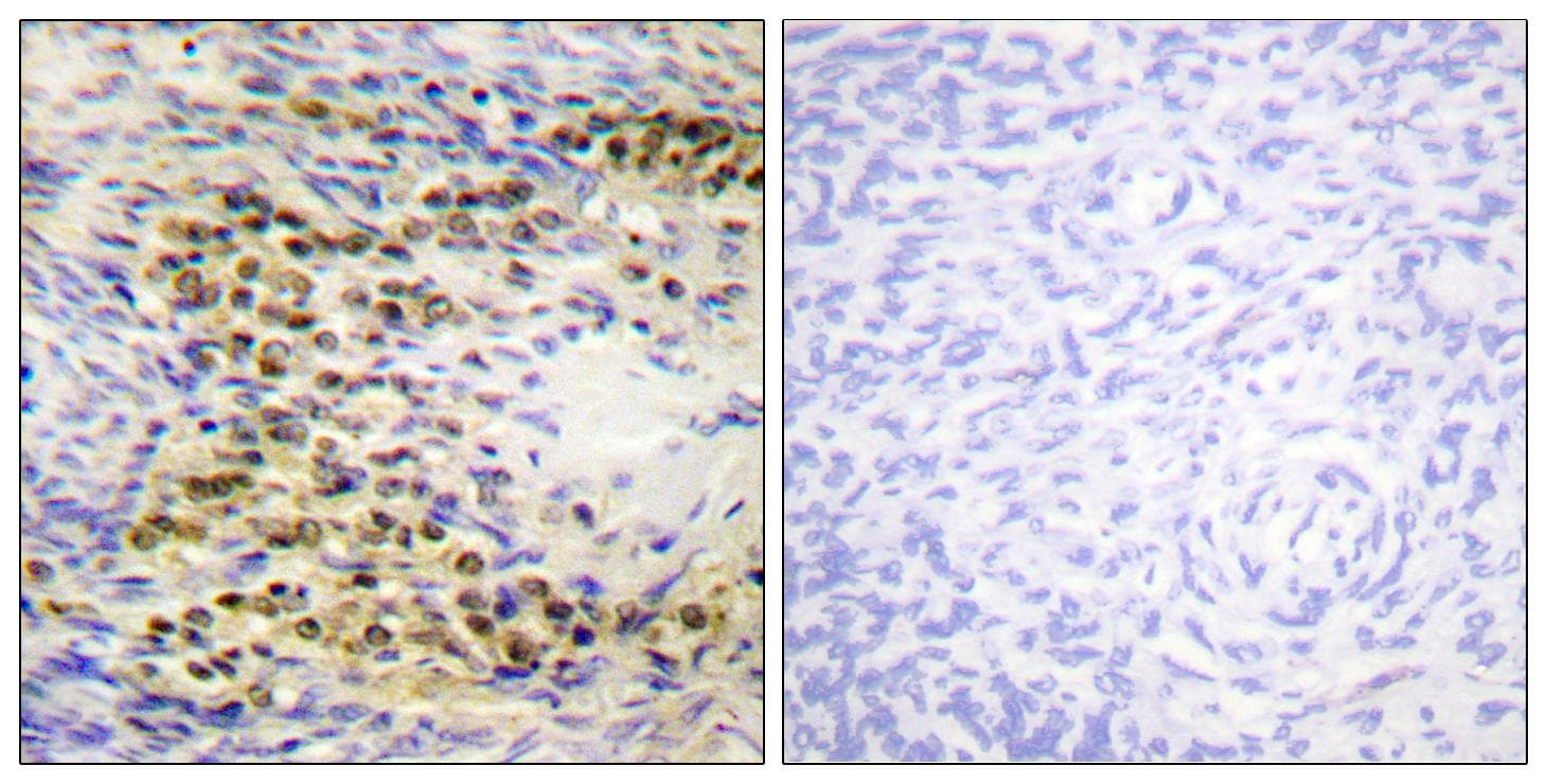 Polyclonal Rabbit anti-Human AKT1 Antibody (phospho-Thr72, IHC, WB)