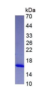 Human FABP4 / AP2 Protein (Recombinant)