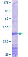 Human TACR1 / NK1R Protein (Recombinant GST, N-terminus)