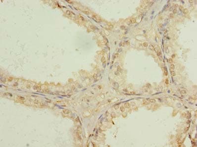 USP47 Antibody (C-Terminus)