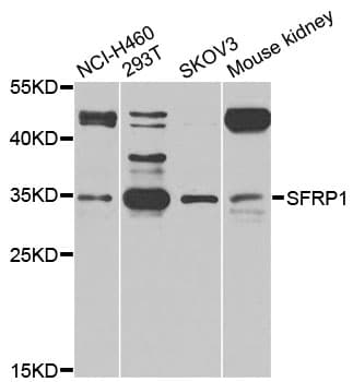 Polyclonal Rabbit anti-Human SFRP1 Antibody (WB)