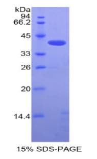 Mouse SIGIRR Protein (Recombinant His-GST)