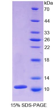 Mouse CXCL7 / PPBP Protein (Recombinant His-T7)