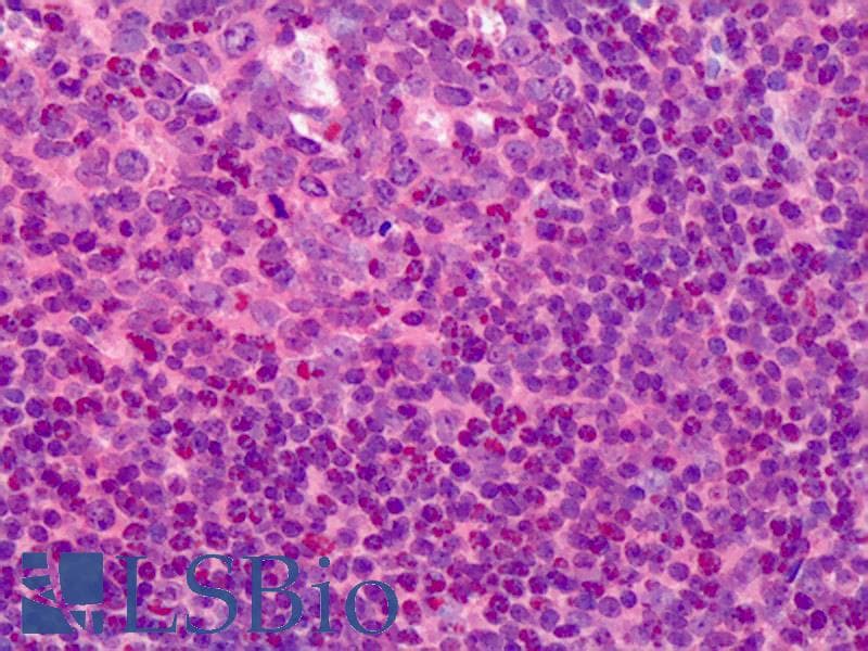 IHC-plus™ TK1 / TK / Thymidine Kinase Antibody (N-Terminus)