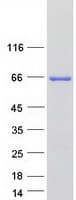 Human CRAT Protein (Recombinant Myc-DDK (Flag))