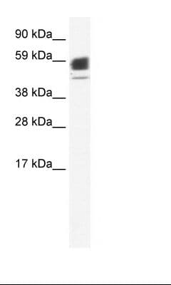 Polyclonal Rabbit anti-Human CHRNA1 Antibody (N-Terminus, WB)