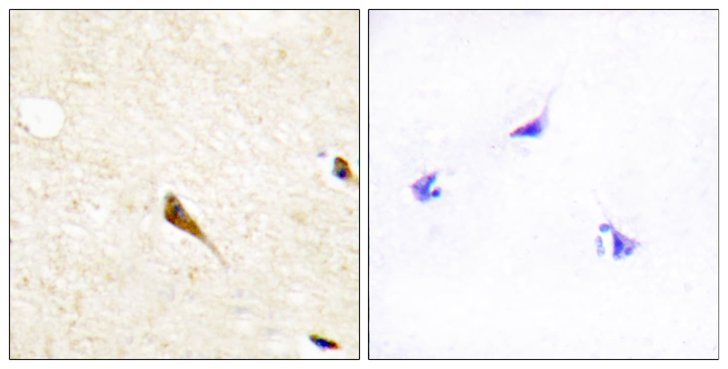 Polyclonal Rabbit anti-Human MOK / RAGE Antibody (aa261-310, IHC, WB)