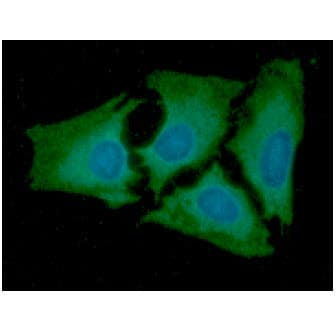 AK2 / Adenylate Kinase 2 Antibody (clone AT7E7)