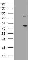FMR1 / FMRP Antibody (aa36-279, clone OTI5B9)
