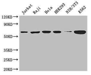 Polyclonal Rabbit anti-Human CCT8 Antibody (IHC, IF, WB)