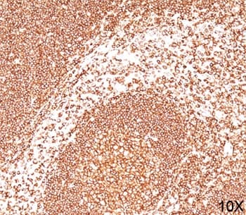 CD45 / LCA Antibody (clone 2B11, Ready-to-Use)