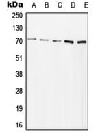 ZAP70 Antibody (phospho-Tyr315)