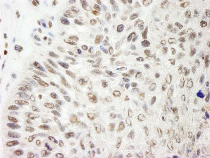 PDS5B / AS3 Antibody (aa1400-C-term)