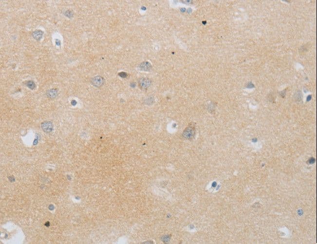 MMP25 / Leukolysin Antibody