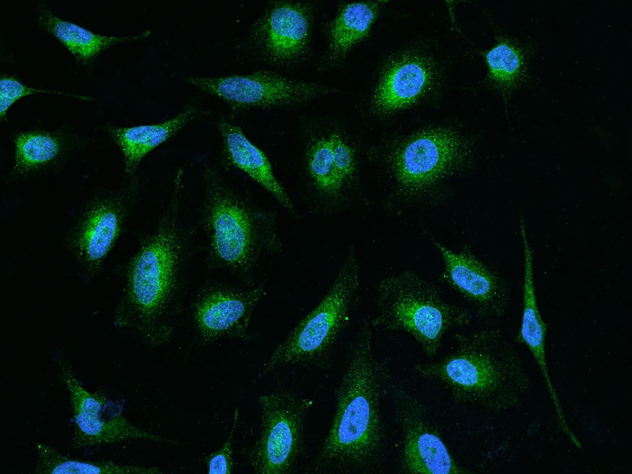 GGCX Antibody