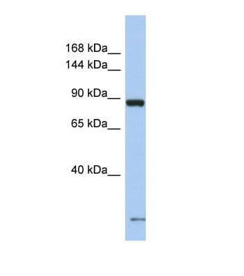 Polyclonal Rabbit anti-Human SCN7A Antibody (aa51-100, WB)