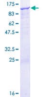 Human ITGB6 / Integrin Beta 6 Protein (Recombinant GST)