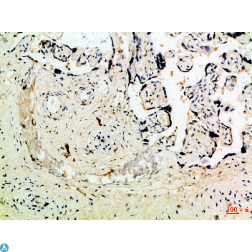 Polyclonal Rabbit anti-Human Leptin Antibody (WB)