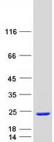 Human WTAP Protein (Recombinant Myc-DDK (Flag))