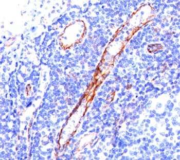 PECAM-1 / CD31 Antibody (clone C31.3, Ready-to-Use)