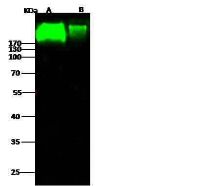 NCAM / CD56 Antibody (Preservative Free)
