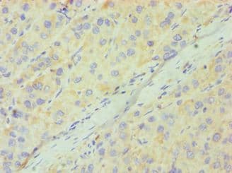 Polyclonal Rabbit anti-Human CD33 Antibody (aa49-259, IHC)