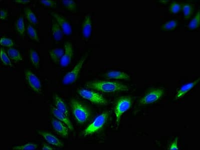 Polyclonal Rabbit anti-Human HTR3D / 5HT3D Receptor Antibody