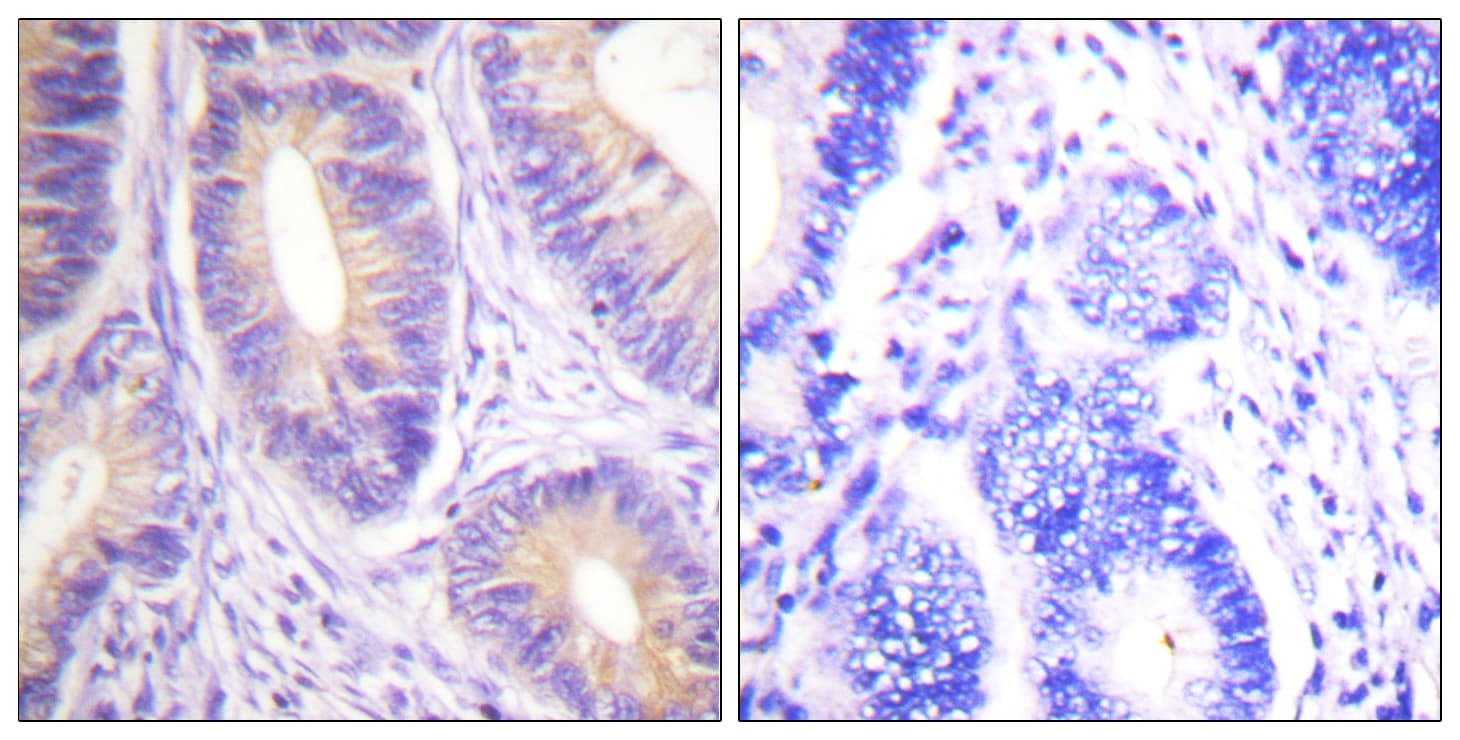 c-CBL Antibody (aa640-689)