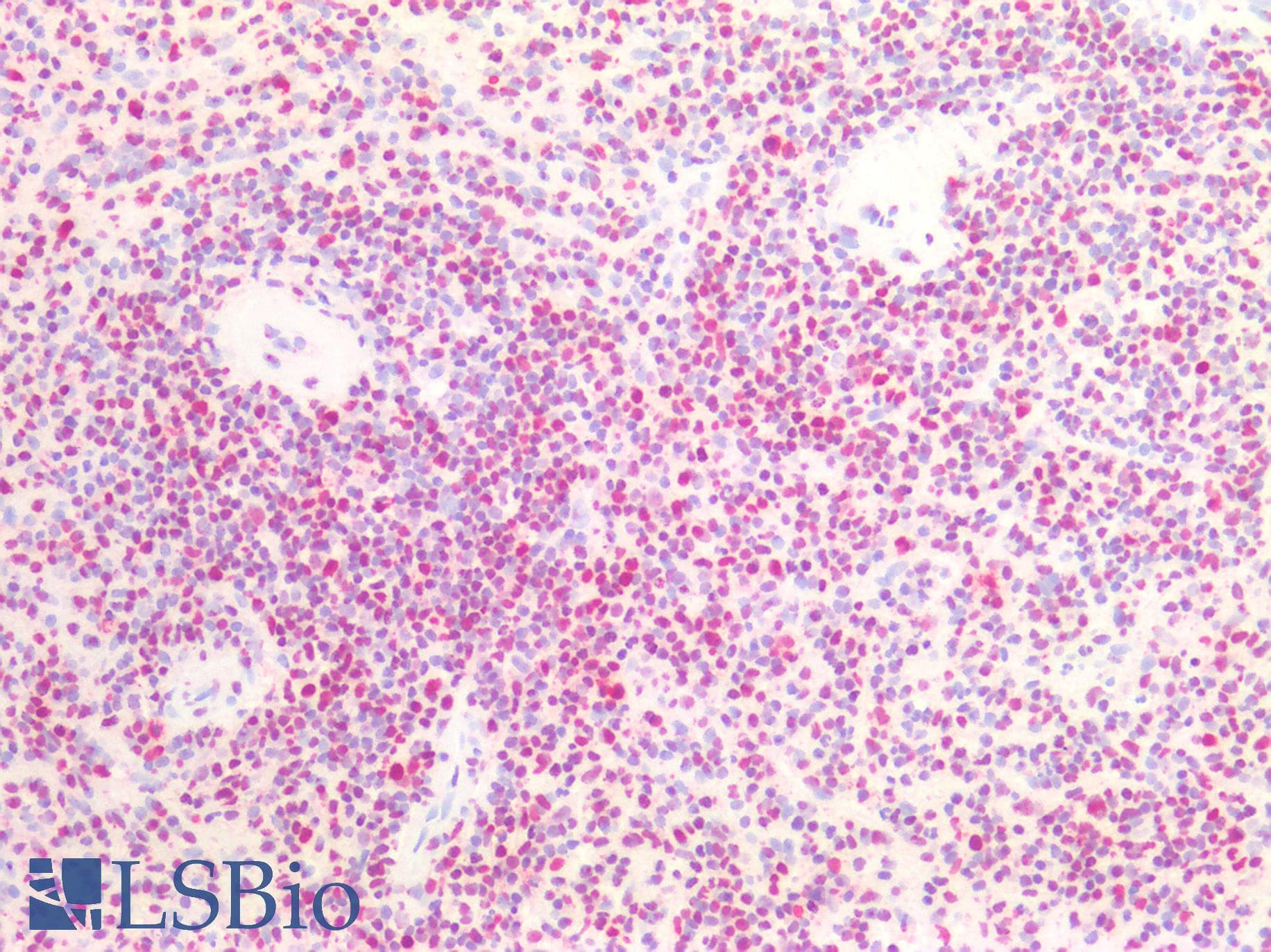 PathPlus™ NPM1 / NPM / Nucleophosmin Antibody (aa204-290)